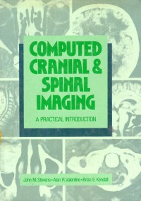 Computed Cranial & Spinal Imaging A Practical Introduction